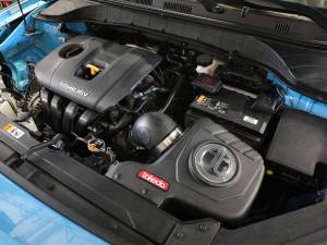 Afe - Advance Flow Engineering - 56-70036D | Takeda Momentum Cold Air Intake System w/ Pro DRY S Filter 2018-2021 Kona L4-2.0L - Image 6