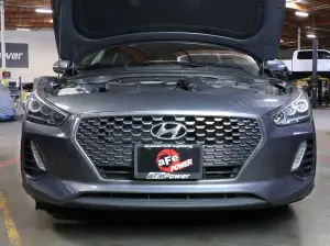Afe - Advance Flow Engineering - 56-70005S | aFe Power Dynamic Air Scoop (D.A.S.) (2018-2020 Elantra GT L4-1.6L t) - Image 4